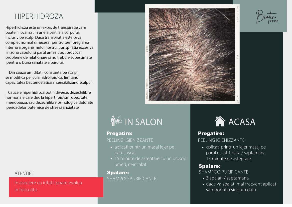 Hiperhidroză