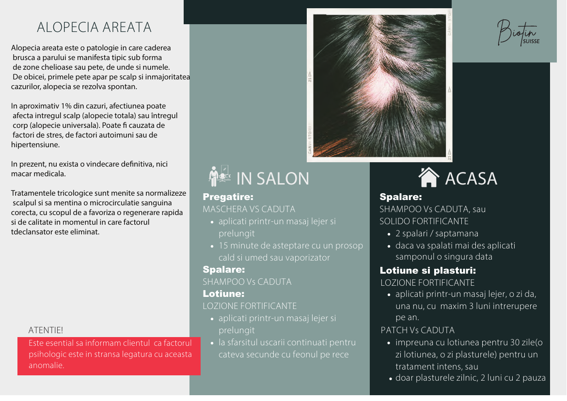 Alopecia areata