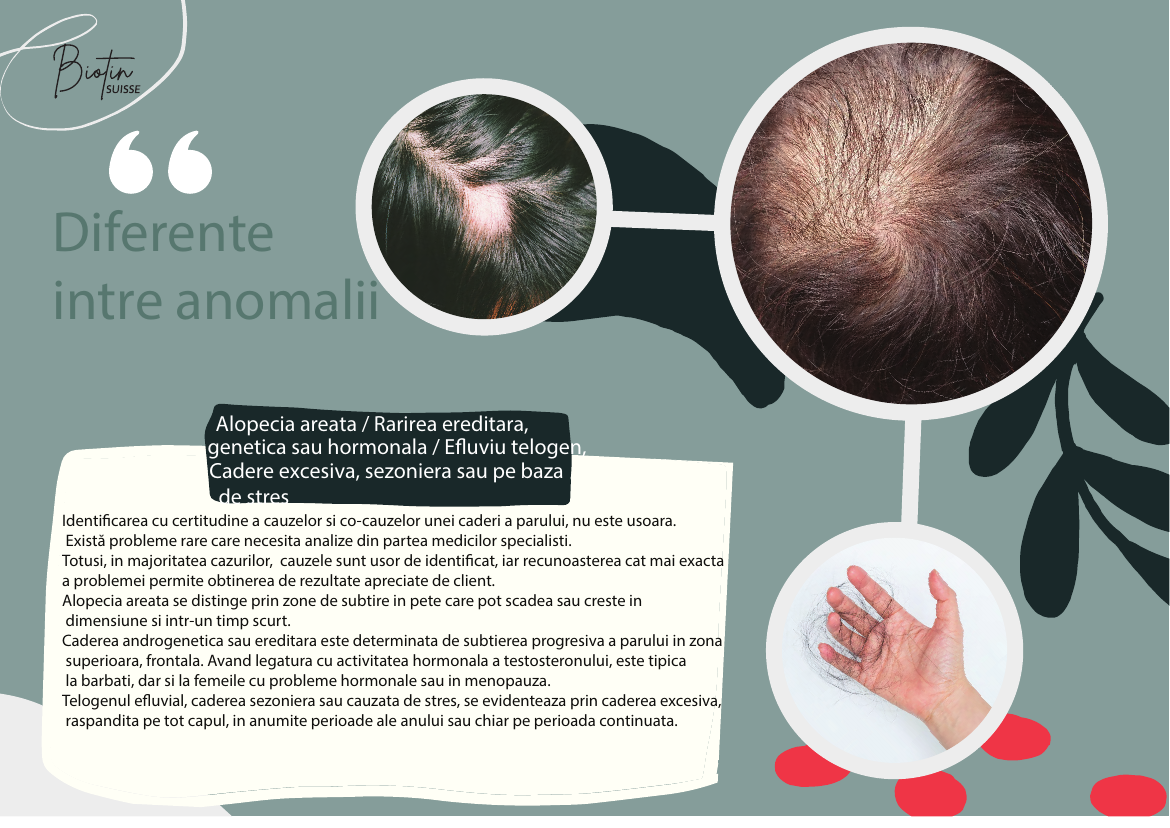 Diferențe între anomalii — cădere de păr